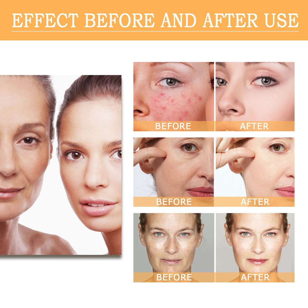 EELHOE Glycolic Acid 7 Lotion Acne Removing Closed Mouth