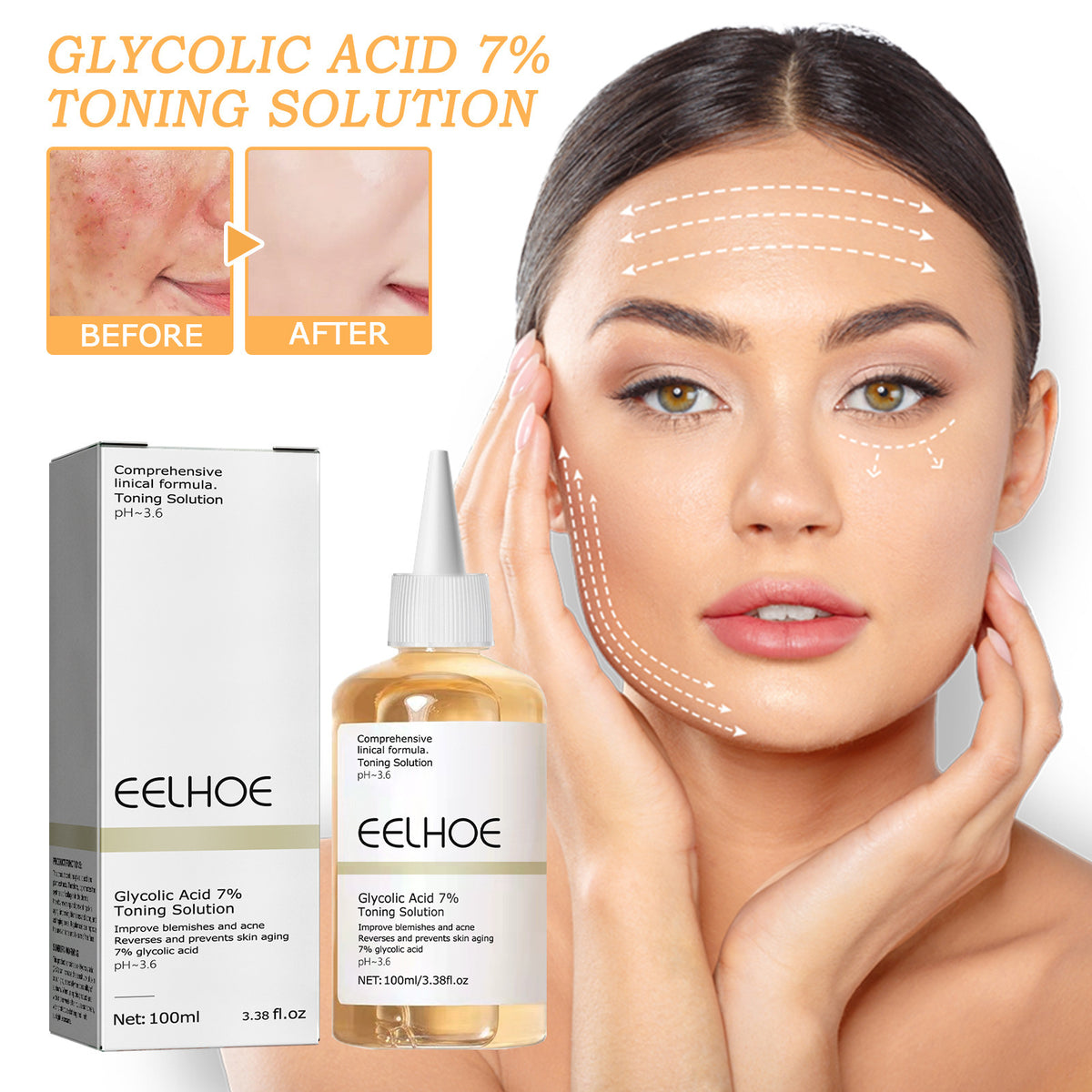 EELHOE Glycolic Acid 7 Lotion Acne Removing Closed Mouth